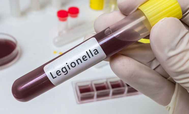 Legionelosis: incubación, síntomas, ¿Qué hacer? 